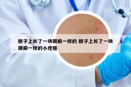 膀子上长了一块跟癣一样的 膀子上长了一块跟癣一样的小疙瘩