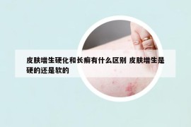 皮肤增生硬化和长癣有什么区别 皮肤增生是硬的还是软的