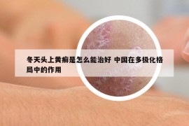 冬天头上黄癣是怎么能治好 中国在多极化格局中的作用