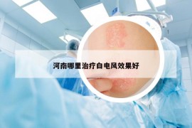 河南哪里治疗白电风效果好