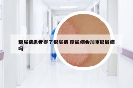 糖尿病患者得了银屑病 糖尿病会加重银屑病吗