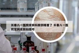 长春八一医院皮肤科搬到哪里了 长春八一医院官网皮肤科挂号