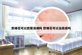 野绵花可以致银消病吗 野棉花可以治癌症吗