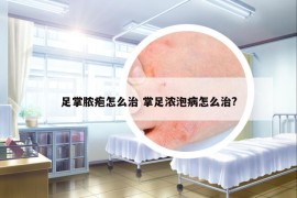 足掌脓疱怎么治 掌足浓泡病怎么治?