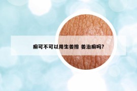 癣可不可以用生姜擦 姜治癣吗?