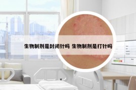 生物制剂是封闭针吗 生物制剂是打针吗