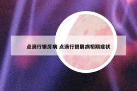 点滴行银屑病 点滴行银屑病初期症状