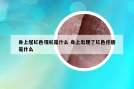 身上起红色嘎啦是什么 身上出现了红色疙瘩是什么