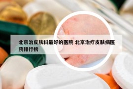 北京治皮肤科最好的医院 北京治疗皮肤病医院排行榜