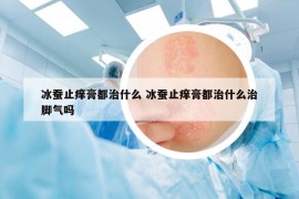 冰蚕止痒膏都治什么 冰蚕止痒膏都治什么治脚气吗