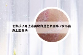 七岁孩子身上涨两块白是怎么回事 7岁小孩身上起白块