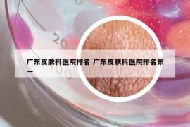 广东皮肤科医院排名 广东皮肤科医院排名第一