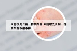 大腿根处长癣一样的东西 大腿根处长癣一样的东西不痛不痒