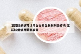 掌跖脓疱病可以用白介素生物制剂治疗吗 掌跖脓疱病用激素软膏