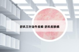 舒氏三针治牛皮癣 舒氏皮肤病