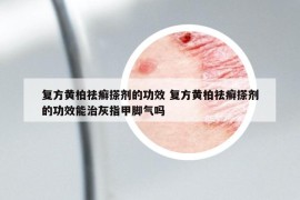 复方黄柏祛癣搽剂的功效 复方黄柏祛癣搽剂的功效能治灰指甲脚气吗