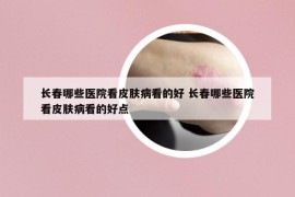 长春哪些医院看皮肤病看的好 长春哪些医院看皮肤病看的好点