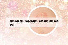 用敌敌畏可以治牛皮癣吗 敌敌畏可以喷牛身上吗