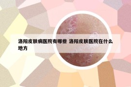 洛阳皮肤病医院有哪些 洛阳皮肤医院在什么地方