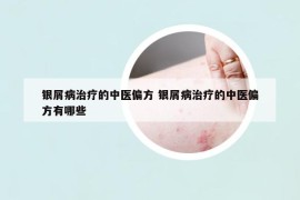 银屑病治疗的中医偏方 银屑病治疗的中医偏方有哪些