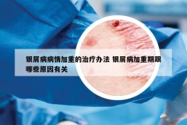 银屑病病情加重的治疗办法 银屑病加重期跟哪些原因有关