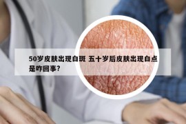 50岁皮肤出现白斑 五十岁后皮肤出现白点是咋回事?