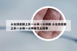 小女孩皮肤上长一小块一小块癣 小女孩皮肤上长一小块一小块癣怎么回事