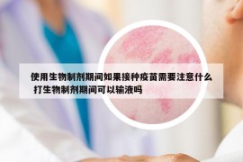 使用生物制剂期间如果接种疫苗需要注意什么 打生物制剂期间可以输液吗