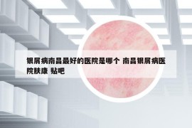 银屑病南昌最好的医院是哪个 南昌银屑病医院肤康 贴吧