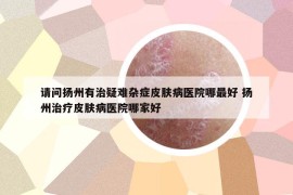 请问扬州有治疑难杂症皮肤病医院哪最好 扬州治疗皮肤病医院哪家好