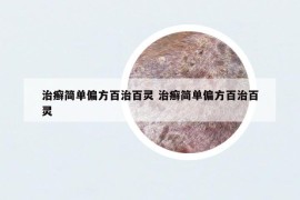 治癣简单偏方百治百灵 治癣简单偏方百治百灵