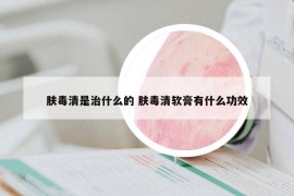 肤毒清是治什么的 肤毒清软膏有什么功效