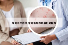 东莞治疗白斑 东莞治疗白斑最好的医院