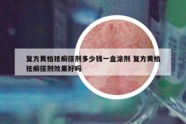 复方黄柏祛癣搽剂多少钱一盒涂剂 复方黄柏祛癣搽剂效果好吗