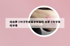 吃水萝卜叶子牛皮癣会恢复吗 水萝卜叶子生吃中毒