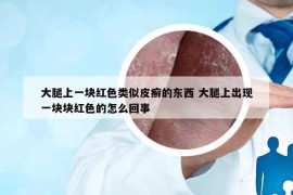 大腿上一块红色类似皮癣的东西 大腿上出现一块块红色的怎么回事