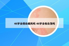 40岁会得白癜风吗 40岁会有白发吗