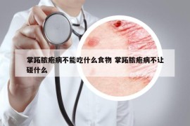 掌跖脓疱病不能吃什么食物 掌跖脓疱病不让碰什么