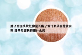 脖子后面头发处像是长癣了涂什么药膏比较有效 脖子后面长藓用什么药