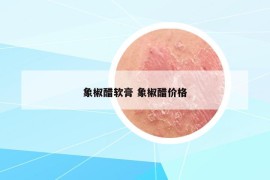 象椒醋软膏 象椒醋价格