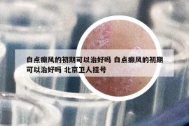 白点癫风的初期可以治好吗 白点癫风的初期可以治好吗 北京卫人挂号