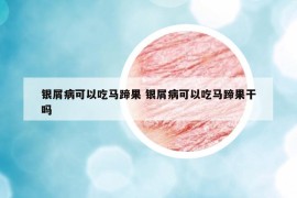 银屑病可以吃马蹄果 银屑病可以吃马蹄果干吗