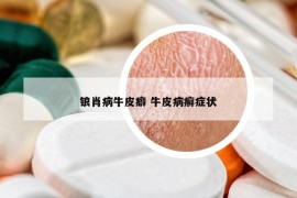 锒肖病牛皮癖 牛皮病癣症状