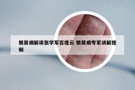 银屑病解读张学军百度云 银屑病专家讲解视频