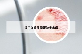 得了白癜风需要做手术吗