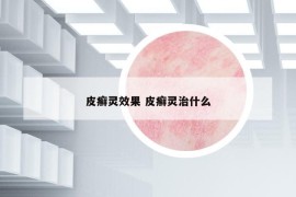 皮癣灵效果 皮癣灵治什么