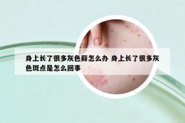 身上长了很多灰色藓怎么办 身上长了很多灰色斑点是怎么回事