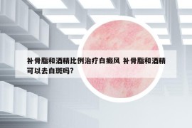 补骨脂和酒精比例治疗白癜风 补骨脂和酒精可以去白斑吗?