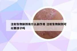 注射生物制剂有什么副作用 注射生物制剂可以要孩子吗