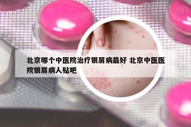 北京哪个中医院治疗银屑病最好 北京中医医院银屑病人贴吧